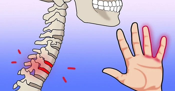 18 علت گزگز، بی حسی و خواب رفتن انگشتان دست