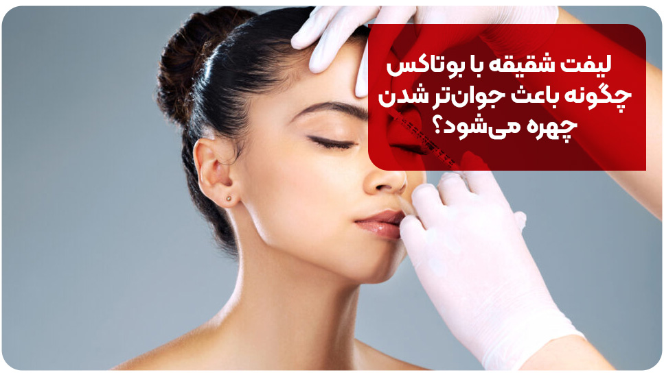 لیفت شقیقه با بوتاکس چگونه باعث جوان‌تر شدن چهره می‌شود؟