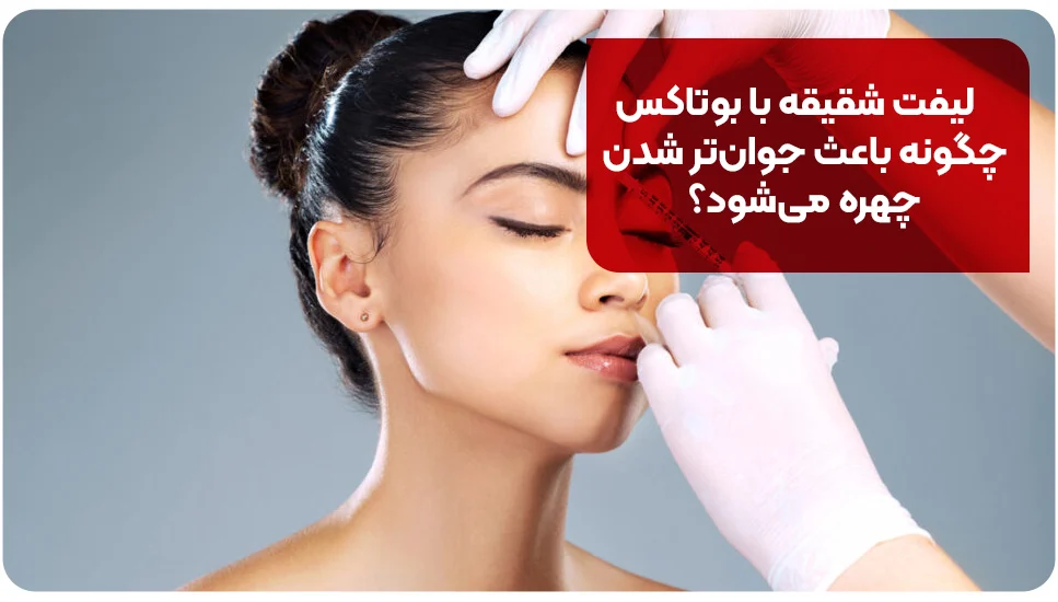 جوانسازی | پوست لیفت شقیقه با بوتاکس چگونه باعث جوانتر شدن چهره میشود؟