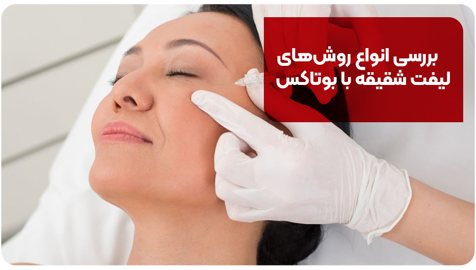بررسی انواع روش‌های لیفت شقیقه با بوتاکس