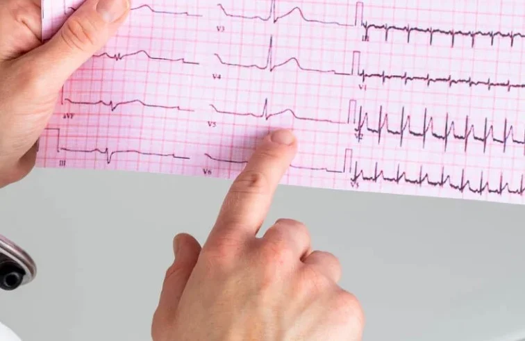بهترین منابع برای یادگیری تفسیر نوار قلب (ECG)